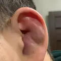 KAGAN